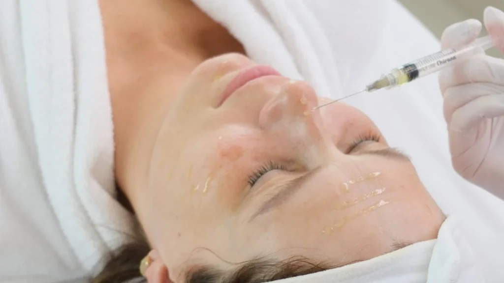 Zabieg BioRePeel z mikronakłuwaniem na twarzy w PRIVE Beauty & Hair w Gdańsku