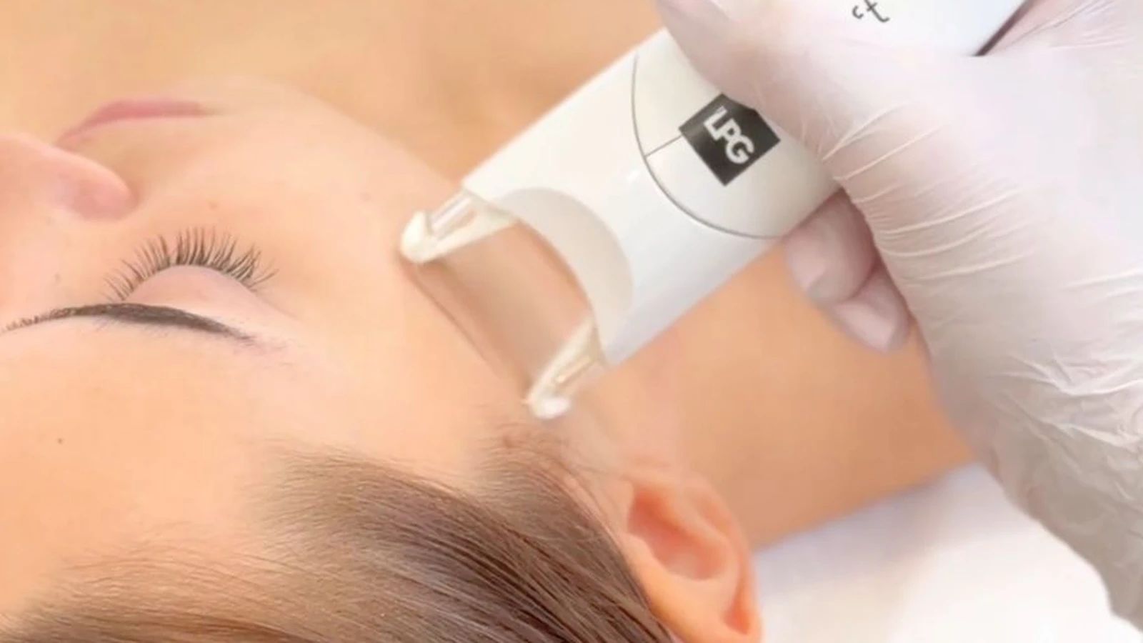 Zabieg liftingujący Endermolift w okolicy skroni w PRIVE Beauty & Hair Gdańsk
