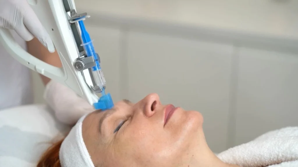 Zabieg mezoterapii z urządzeniem Vital Injector na twarzy w PRIVE Beauty & Hair w Gdańsku