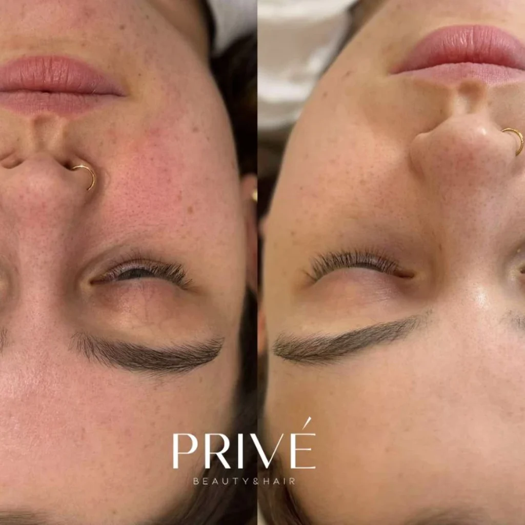 Peeling PCA Skin – poprawa kondycji cery przed i po w PRIVE Gdańsk