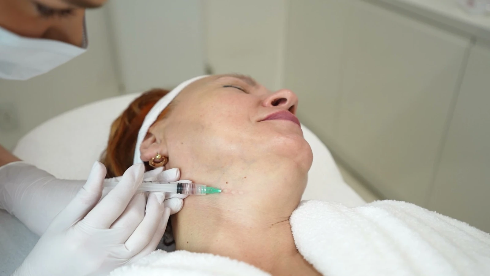 Podanie tropokolagenu Guna igłą w skórę twarzy w PRIVE Beauty & Hair Gdańsk