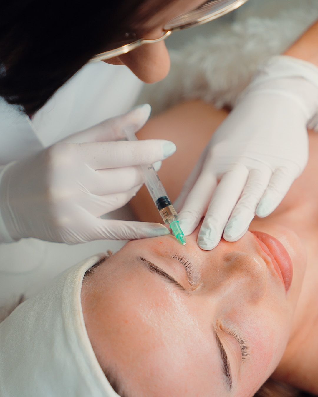 Mezoterapia iglowa twarzy w Prive Beauty Clinic w Gdansku